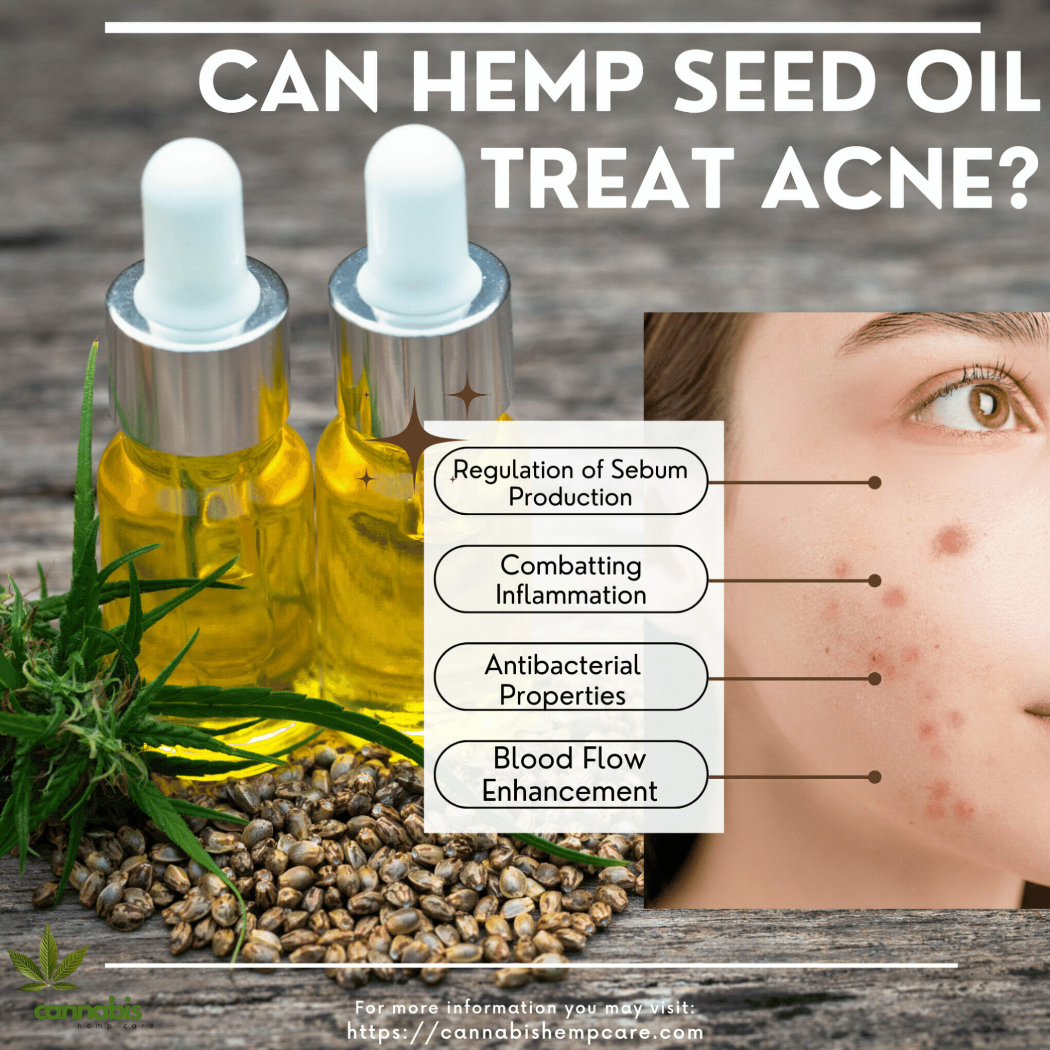 Hemp Seed Oil can Treat Acne