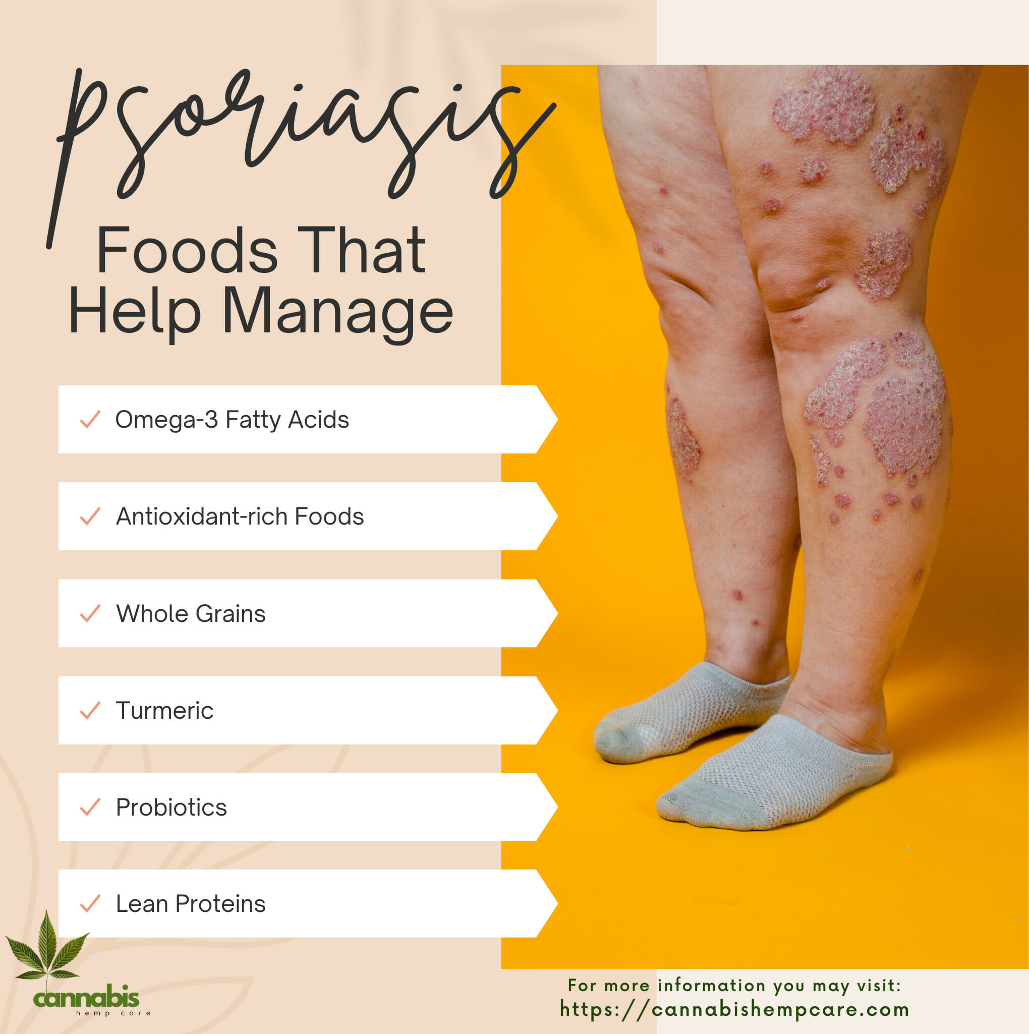 Foods That Help Manage Psoriasis