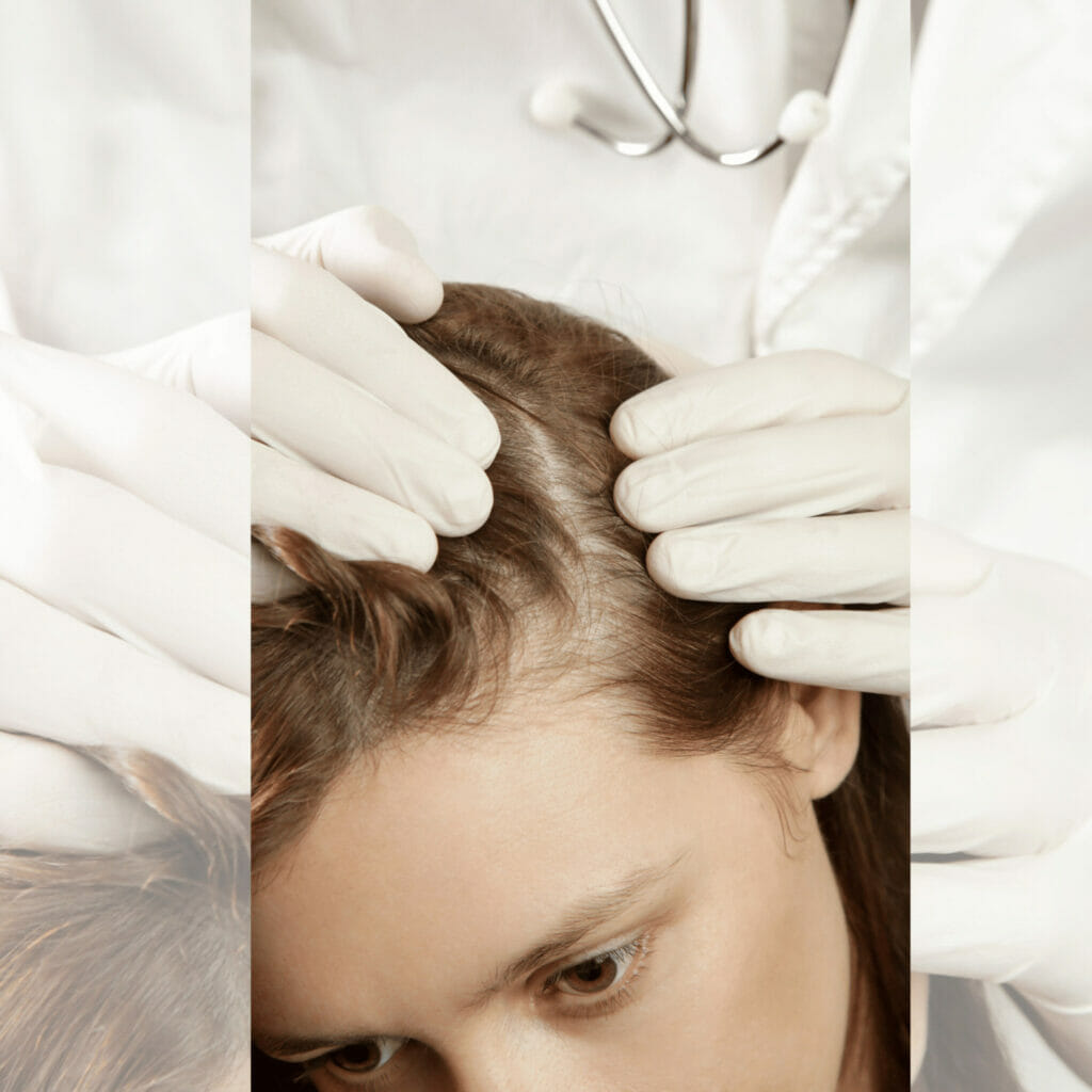 derma checking up scalp