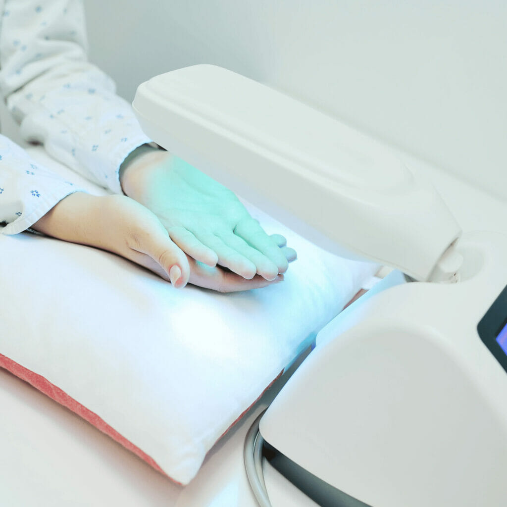 example of psoriasis treatment, phototherapy