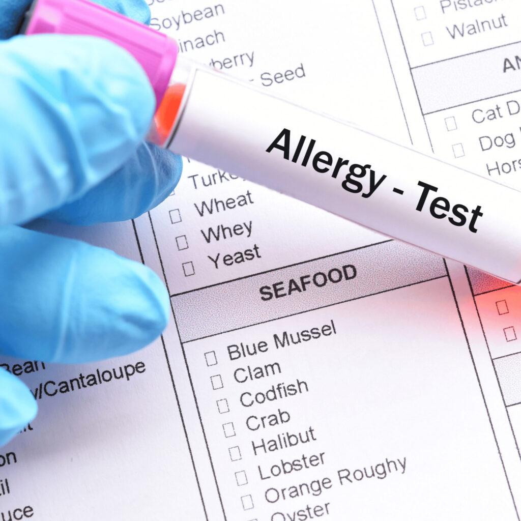 allergy test