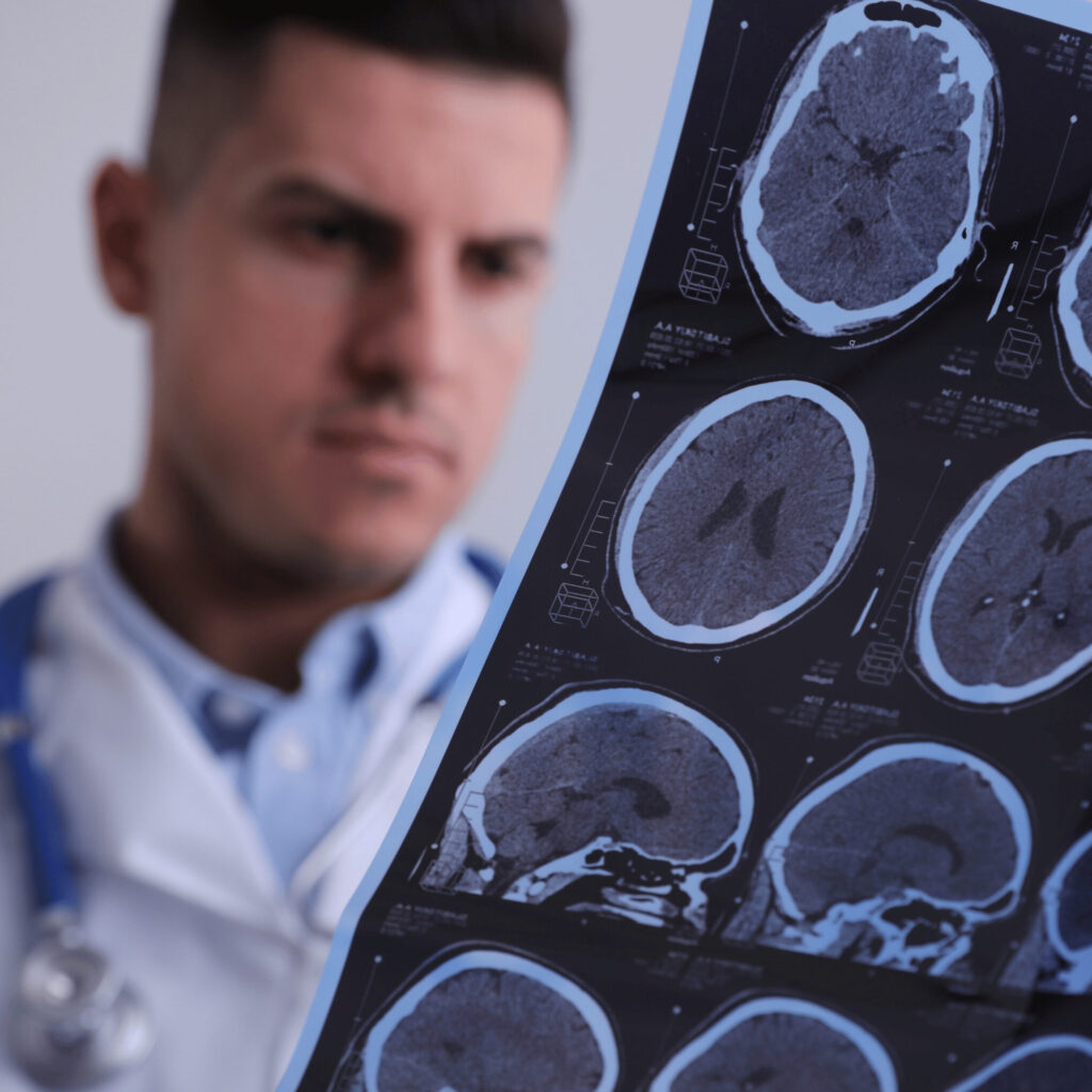 Doctor Examining MRI Images of Patient with Multiple Sclerosis I