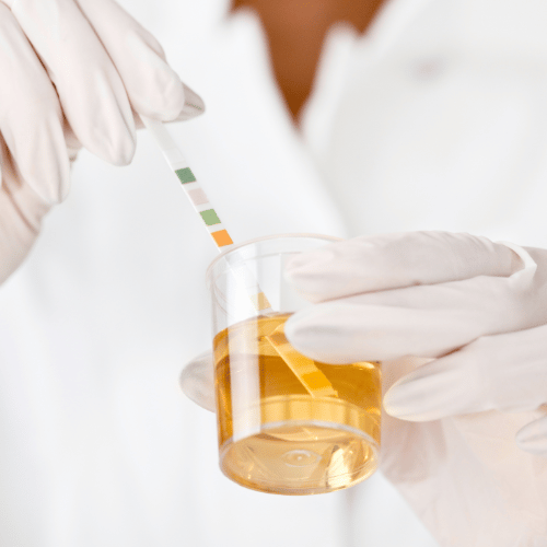 urine sample for drug testing